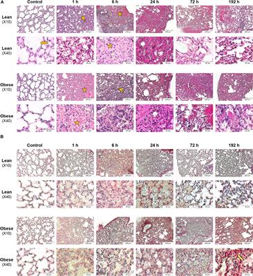 Influence of Obesity on the Organization of the Extracellular Matrix and Satellite Cell Functions After Combined Muscle and Thorax Trauma in C57BL/6J Mice